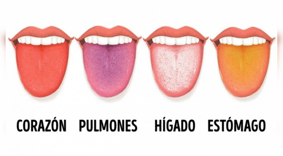 Заболевания по цвету языка