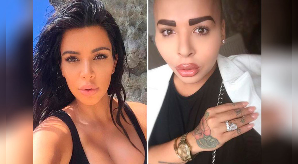 Él Se Operó Para Lucir Como Kim Kardashian Pero Las Cosas No Le