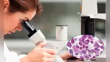 Alerta: Científicos descubren peligrosa ETS, esto debes saber de la ‘Mycoplasma genitalium’