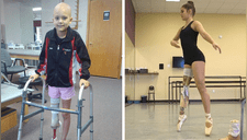 Perdió su pierna, pero su pasión por el baile fue intensa; su talento asombra a todos (FOTOS)