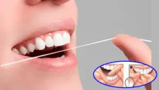 ¿Realmente sirve usar hilo dental para limpiar nuestros dientes? Lo que los odontólogos no dicen 