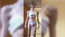 La anorexia se apoderó de ella en su adolescencia, se recuperó y ahora luce increíble [FOTOS]