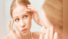 No espere que le suceda y use estos tips indispensables para prevenir el acné