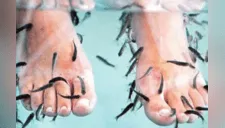 Mujer se sometió a una terapia con peces y pierde todos los dedos de un pie 