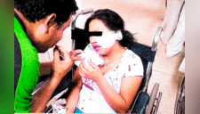 3 venezolanas son sospechosas de desfigurar en el rostro a joven universitaria [FOTOS] 