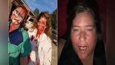 Halloween 2018: mujer no pudo quitarse dientes de zombie y el desenlace es escalofriante [FOTOS] 