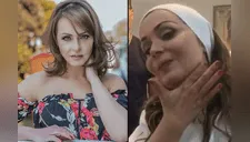 Gabriela Spanic transforma su rostro con botox y luce irreconocible a sus 44 años [FOTOS] 