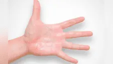 ¿Te sudan las manos? Tres ‘tips’ naturales para reducir este problema