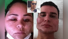 Doctor dejó caras “deformadas” a pacientes al practicarles estiramiento facial y ahora lo buscan [FOTOS] 