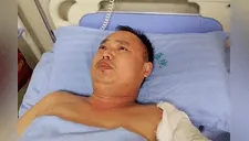 Padre dona piel de su brazo, cabeza y pierna para salvar a su hija víctima de un incendio [VIDEO]