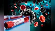 VIH: descubren una forma para eliminar las células infectadas