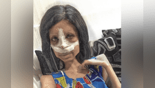 Las escalofriantes fotos de Sahar Tabar, la Angelina Jolie “zombie” tras nueva cirugía en su rostro