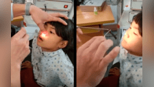 Médicos extraen una sanguijuela viva dentro de la nariz de una niña [VIDEO]