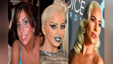 Lady Gaga: Se filtran imágenes donde exhiben su antes y después [FOTO]
