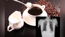 Mujer adicta al café se rompe tres costillas durante un ataque de tos; tomaba 10 tazas diarias