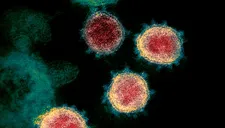 NVIDIA ofrece tecnología para combatir coronavirus