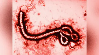 Virus del ébola.