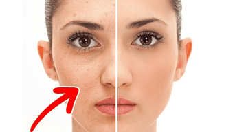 El rostro y la piel cambiarán drásticamente gracias al producto