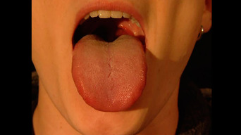 ¿Tienes esas marcas en tu lengua?