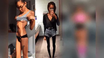 Holly Griffiths, de 27 años, mostró su increíble transformación tras padecer de Anorexia por muchos años