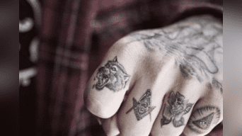 Hombre intenta sacarse tatuaje con procedimiento láser y obtiene terrorífico resultado