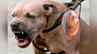 Perro arrancó el dedo de una mujer a través del buzón de correo.