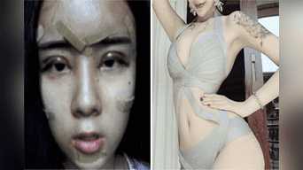Asiática se opera el rostro para recuperar a su ex y así luce tras las cirugías. 