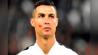 Ronaldo y todos los jugadores del fútbol italiano salieron a las canchas con una misteriosa mancha roja en la mejilla debida a una iniciativa de la ONU