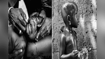 “Niños marcados con cuchillas en su rostro”: tribu africana lo realiza como signo de belleza. 