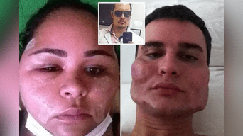Doctor dejó caras “deformadas” a pacientes al practicarle estiramiento facial. 