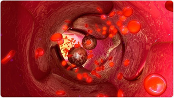Científicos desarrollan una cámara endoscópica tan pequeña que permite mirar dentro de los vasos sanguíneos (FOTOS)