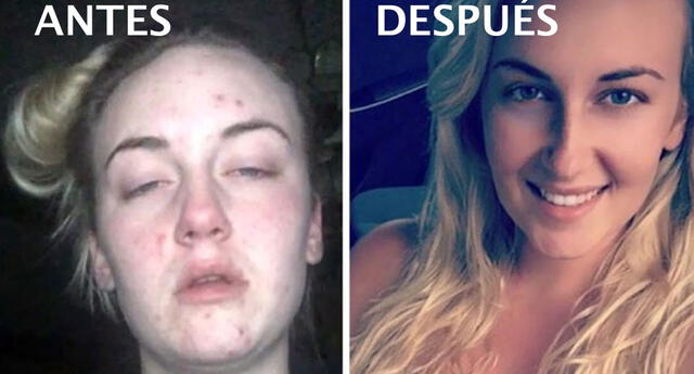 ¿Cómo luce una persona antes y después de consumir drogas? 7 fotografías lo revelan
