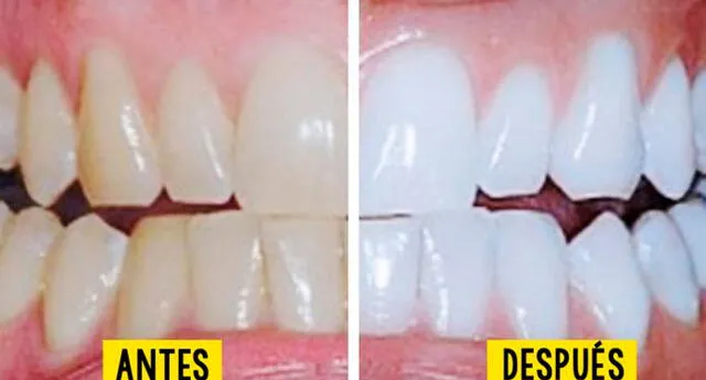 Conoce los 3 ingredientes para blanquear los dientes de manera natural