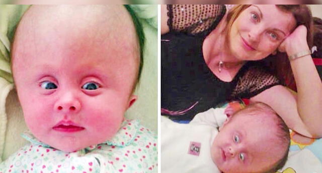 Nació con hidrocefalia, pero gracias a su madre hoy luce increíble