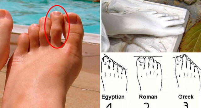  ¿El pie perfecto? Esto es lo que significa tener el segundo dedo del pie más largo