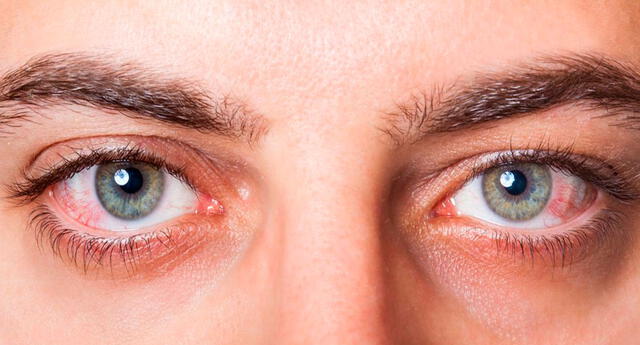 8 señales que tu salud no está bien, tus ojos pueden revelar algunas enfermedades