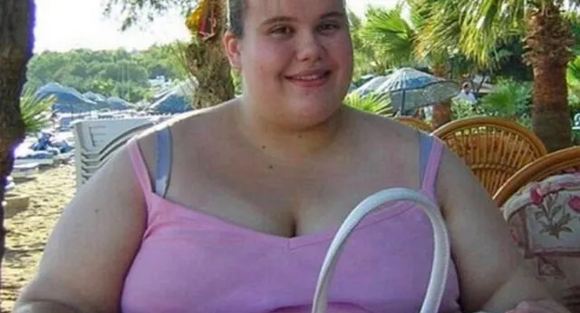 Ella era obesa y por temor a seguir engordando se volvió anoréxica (FOTOS)