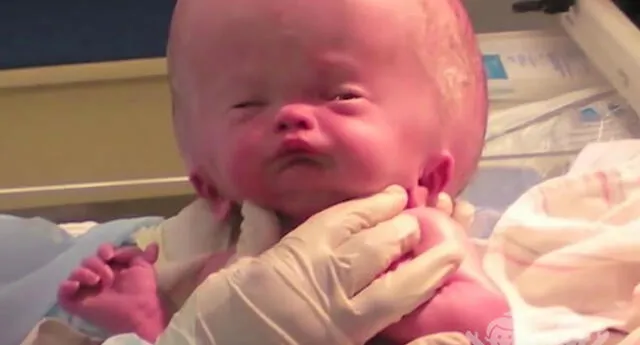 Nació con hidrocefalia, tras 20 meses de tratamiento, médicos lo llaman ‘bebé milagro’
