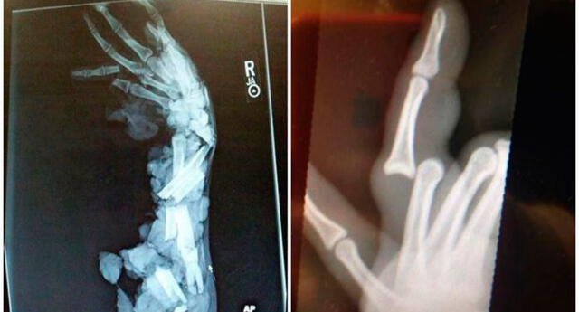 7 fotografías de rayos X que son una verdadera pesadilla