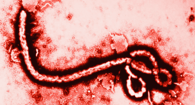 Virus del ébola.