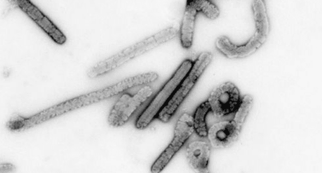 Después del último caso presentado en el 2012, virus del Marburg vuelve a cobrar una vida en Uganda.