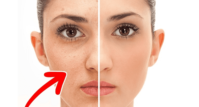 El rostro y la piel cambiarán drásticamente gracias al producto