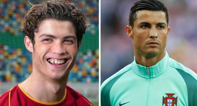 Estas cirugías transformaron a Cristiano Ronaldo.
