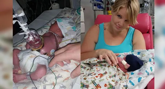 Su bebé nacería con los órganos afuera, le dijeron que abortara, pero ella no obedeció
