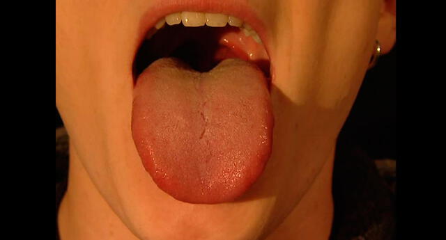 ¿Tienes esas marcas en tu lengua?