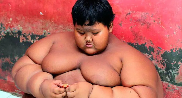 Vive en Indonesia y es considerado "el niño más gordo del mundo"