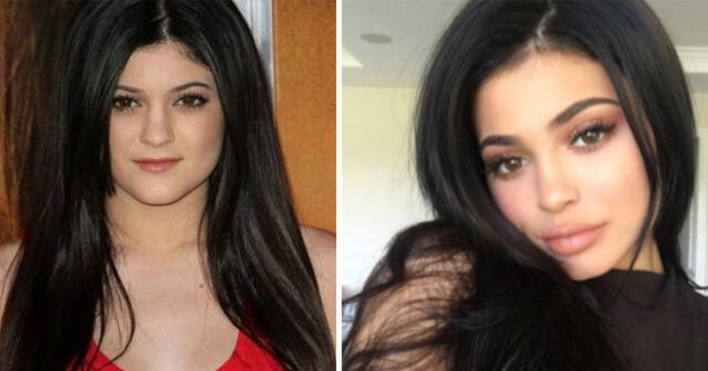 A pesar de los evidentes cambios, las hermanas Kardashian negaban todo. 