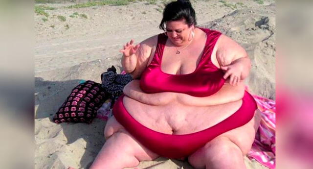 Llegó a pesar 323 kilos para ser más gorda del mundo, se arrepintió y luce así