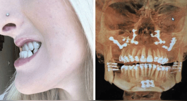 Una cirugía mejoró el problema de su mandíbula