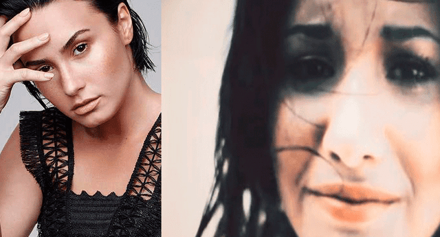 Demi Lovato fue hospitalizada el último martes a raíz de una supuesta sobredosis de heroína